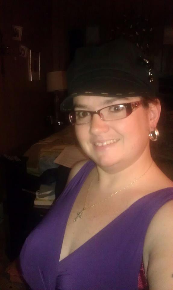 2 YRS AFTER GASTRIC BYPASS (1) 5 4 12