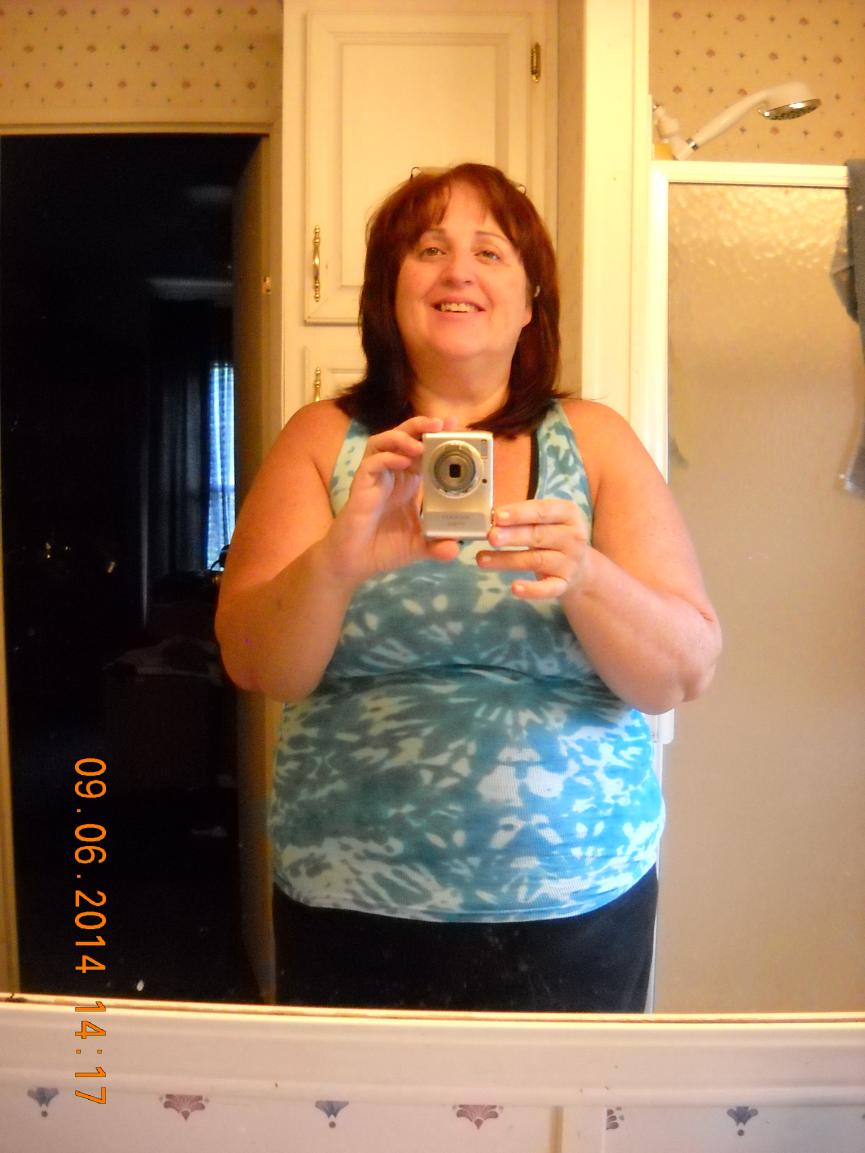 3 days after surgery