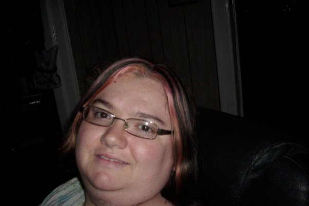 5 DAYS B4 SURGERY(2) 2 17 10