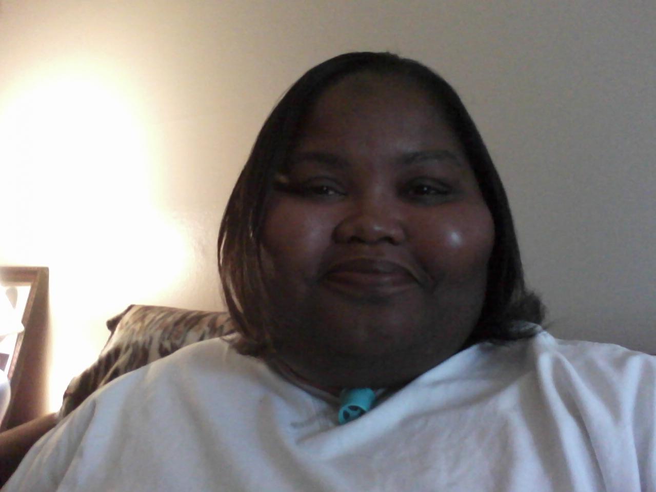 This picture was taken 4 monthsl before the surgery.