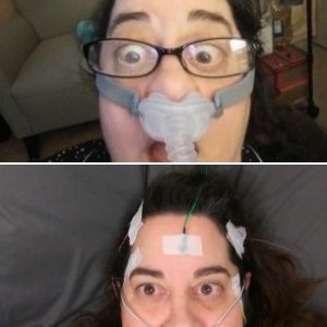 Before Surgery