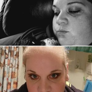 Pre surgery pics