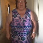 Linda Pre Op2