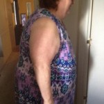 Linda Pre op