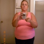 2 weeks post op. Sept 12, 2014