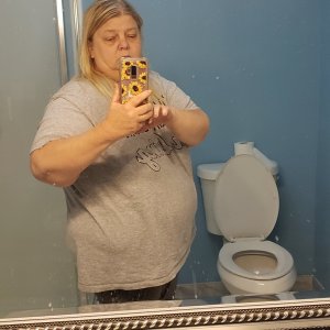 before surgery june 2020.jpg
